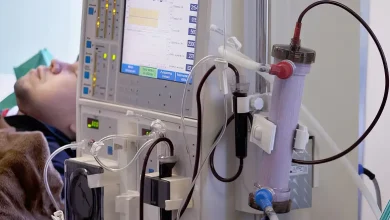 Estudo alerta para subdiagnóstico da doença renal crônica no Brasil Estudo alerta para subdiagnóstico da doença renal crônica no Brasil